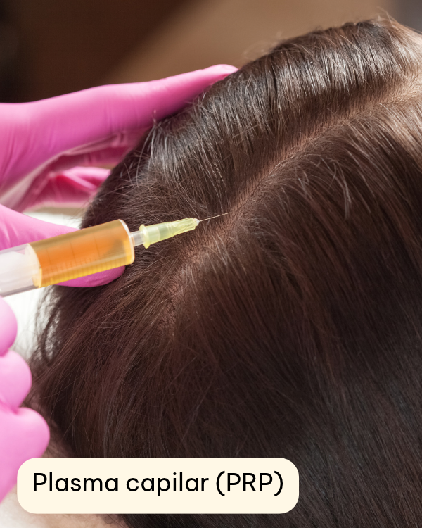 Plasma capilar (PRP)