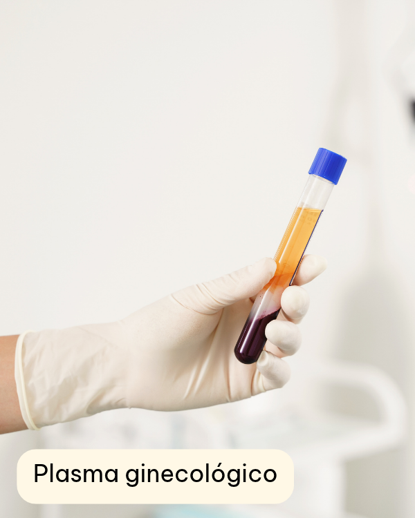 Plasma ginecológico